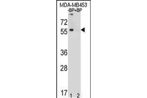 Western blot analysis of TOX3 Antibody Pab pre-incubated without(lane 1) and with(lane 2) blocking peptide in MDA-MB453 cell line lysate (TOX3 antibody  (AA 214-242))
