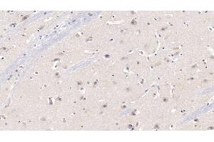 Detection of KPNa3 in Human Cerebrum Tissue using Polyclonal Antibody to Karyopherin Alpha 3 (KPNa3)