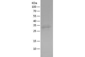Western Blotting (WB) image for EH-Domain Containing 1 (EHD1) (AA 265-317) protein (His-IF2DI Tag) (ABIN7281960) (EHD1 Protein (AA 265-317) (His-IF2DI Tag))