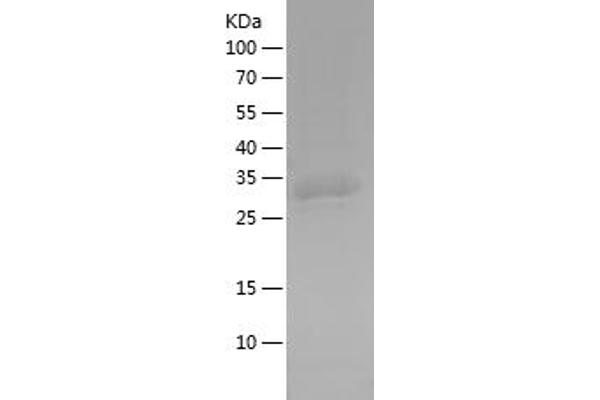 EHD1 Protein (AA 265-317) (His-IF2DI Tag)