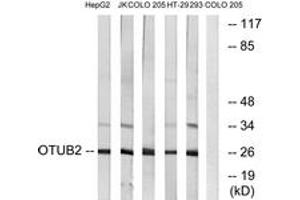 Western blot analysis of extracts from COLO/HepG2/Jurkat/293/HT-29 cells, using OTUB2 Antibody. (OTUB2 antibody  (AA 133-182))