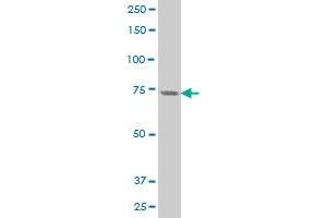 PKC eta antibody  (AA 1-100)