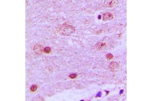 Immunohistochemical analysis of PAK7 staining in human brain formalin fixed paraffin embedded tissue section. (PAK7 antibody  (C-Term))