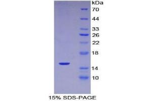 SDS-PAGE analysis of Mouse Complement 1 Inhibitor Protein.
