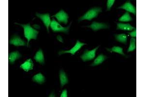 Image no. 4 for anti-Spermine Synthase, SMS (SMS) antibody (ABIN1501098) (SMS antibody)