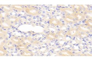 Detection of C1INH in Mouse Kidney Tissue using Polyclonal Antibody to Complement 1 Inhibitor (C1INH) (SERPING1 antibody  (AA 211-331))