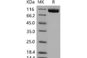 Western Blotting (WB) image for Fms-Related Tyrosine Kinase 4 (FLT4) (Active) protein (His tag) (ABIN7195831) (FLT4 Protein (His tag))