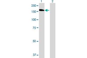Lane 1: HDAC6 transfected lysate ( 133.