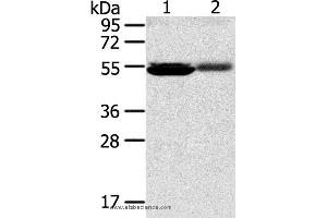 Western blot analysis of Human kidney pericarcinous and kidney cancer tissue, using SLC17A1 Polyclonal Antibody at dilution of 1:200