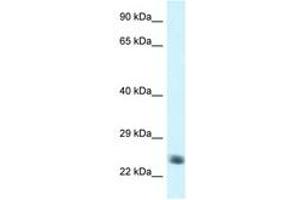 Image no. 1 for anti-NADH Dehydrogenase (Ubiquinone) Fe-S Protein 8, 23kDa (NADH-Coenzyme Q Reductase) (NDUFS8) (AA 114-163) antibody (ABIN6747459) (NDUFS8 antibody  (AA 114-163))