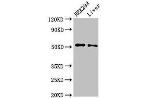 Western Blot Positive WB detected in: HEK293 whole cell lysate, Rat liver tissue All lanes: IFIT2 antibody at 3 μg/mL Secondary Goat polyclonal to rabbit IgG at 1/50000 dilution Predicted band size: 55 kDa Observed band size: 55 kDa (IFIT2 antibody  (AA 130-265))