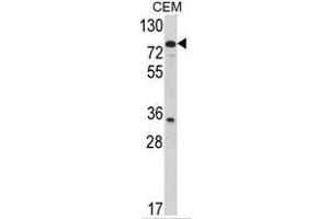 Western blot analysis of TGM4 Antibody (Center) in CEM cell line lysates (35ug/lane). (TGM4 antibody  (Middle Region))
