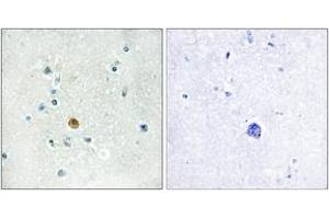 Immunohistochemistry (IHC) image for anti-Interferon Regulatory Factor 3 (IRF3) (AA 362-411) antibody (ABIN1532452)