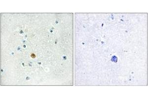 Immunohistochemistry analysis of paraffin-embedded human brain tissue, using IRF3 (Ab-396) Antibody. (IRF3 antibody  (AA 362-411))