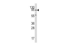 Western blot analysis of DNMT3A Antibody (C-term) (ABIN387865 and ABIN2844047) in HepG2 cell line lysates (35 μg/lane). (DNMT3A antibody  (C-Term))