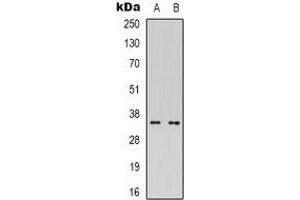 Western blot analysis of CDC42EP4 expression in Hela (A), Jurkat (B) whole cell lysates. (CDC42EP4 antibody)