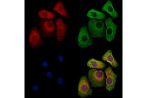 ABIN6262800 and ABIN6273259 staining Hela cells by IF/ICC.