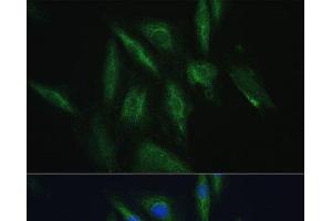 Immunofluorescence analysis of H9C2 cells using SRPRB Polyclonal Antibody at dilution of 1:100. (SRPRB antibody)