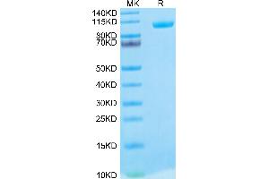 Biotinylated Human MMP-9 on Tris-Bis PAGE under reduced condition. (MMP 9 Protein (His-Avi Tag,Biotin))