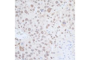 Immunohistochemistry (IHC) image for anti-Leo1, Paf1/RNA Polymerase II Complex Component, Homolog (S. Cerevisiae) (LEO1) (AA 550-600) antibody (ABIN7453950)