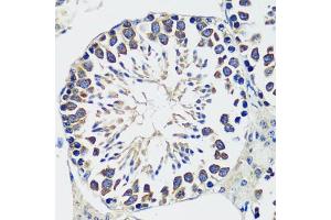 Immunohistochemistry of paraffin-embedded mouse testis using CCDC124 antibody  at dilution of 1:100 (40x lens). (CCDC124 antibody  (AA 1-223))