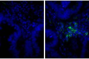 Paraffin embedded human gastric cancer tissue was stained with Rabbit IgG-UNLB isotype control and DAPI. (Donkey anti-Rabbit IgG (Heavy & Light Chain) Antibody (FITC))