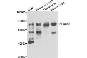 Western blot analysis of extracts of various cell lines, using ALOX15 antibody (ABIN5975430) at 1/1000 dilution. (ALOX15 antibody)
