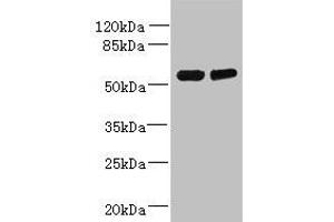 Western blot All lanes: TCTE1 antibody at 3 μg/mL Lane 1: U251 whole cell lysate Lane 2: Mouse brain tissue Secondary Goat polyclonal to rabbit IgG at 1/10000 dilution Predicted band size: 56 kDa Observed band size: 56 kDa (TCTE1 antibody  (AA 285-501))