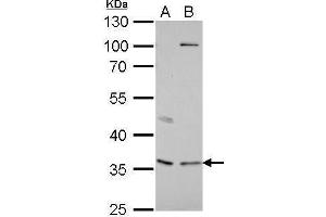 WB Image Decorin antibody detects DCN protein by Western blot analysis. (Decorin antibody)