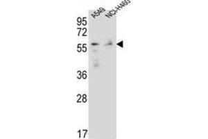 Western Blotting (WB) image for anti-Forkhead Box N1 (FOXN1) antibody (ABIN2996514) (FOXN1 antibody)