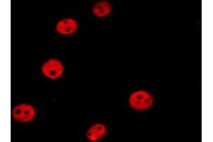 ABIN6277203 staining HepG2 by IF/ICC.