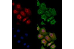 Phospho-A20/TNFAIP3 (Ser381) Antibody staining Hela cells(heat shock treatment) by IF/ICC.