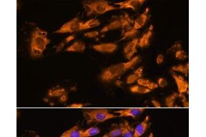 Immunofluorescence analysis of C6 cells using ASPM Polyclonal Antibody at dilution of 1:100. (ASPM antibody)