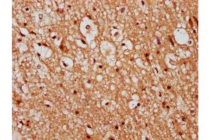 IHC image of ABIN7147330 diluted at 1:300 and staining in paraffin-embedded human brain tissue performed on a Leica BondTM system. (TMEM2 antibody  (AA 734-866))