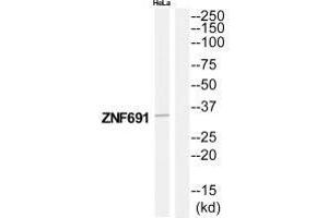 Western blot analysis of extracts from HeLa cells, using ZNF691 antibody. (ZNF691 antibody)