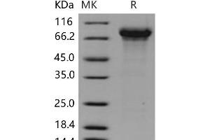 Western Blotting (WB) image for Kininogen 1 (KNG1) (Active) protein (His tag) (ABIN7196714)