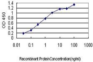 Detection limit for recombinant GST tagged CYorf15B is approximately 0. (CYorf15B antibody  (AA 82-180))