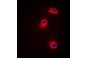 Immunofluorescent analysis of CaMK1 alpha (pT177) staining in Jurkat cells. (CAMK1 antibody  (pSer177))