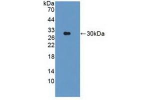 Figure. (Parkin antibody  (AA 229-465))