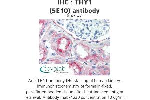 Image no. 1 for anti-CD90 (THY1) antibody (ABIN1724058)