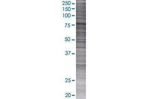 FEM1A transfected lysate. (FEM1A 293T Cell Transient Overexpression Lysate(Denatured))