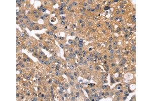 Immunohistochemistry (IHC) image for anti-Solute Carrier Family 2 (Facilitated Glucose Transporter), Member 2 (SLC2A2) antibody (ABIN2425996) (SLC2A2 antibody)