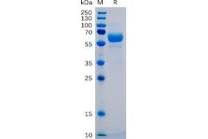 Human SIGLEC15 Protein, mFc-His Tag on SDS-PAGE under reducing condition.