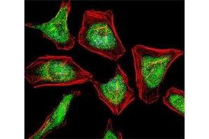 Fluorescent confocal image of HeLa cell stained with ATF7 antibody at 1:25. (ATF7 antibody  (AA 68-96))