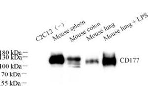 Western blot analysis of CD177 (ABIN7073372)at dilution of 1: 1000 (CD177 antibody)