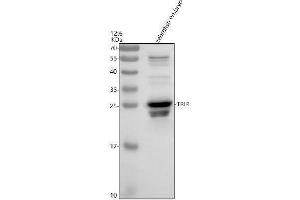 anti-Uncharacterized Protein C19orf43 (TRIR) (AA 144-164) antibody