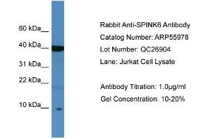 WB Suggested Anti-SPINK6  Antibody Titration: 0. (SPINK6 antibody  (Middle Region))