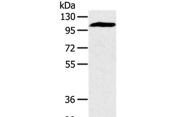 PYGM antibody