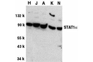 Western Blotting (WB) image for anti-Signal Transducer and Activator of Transcription 1, 91kDa (STAT1) (C-Term) antibody (ABIN1030701) (STAT1 antibody  (C-Term))