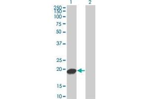 Western Blot analysis of UBE2C expression in transfected 293T cell line by UBE2C monoclonal antibody (M04), clone 3B1.